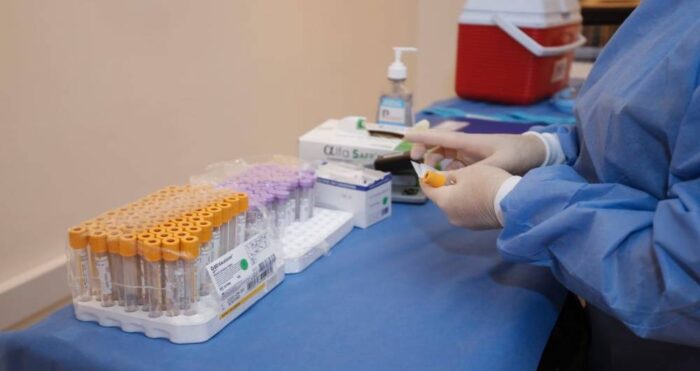 La Junta de Andalucía retira el muerto en Priego de Córdoba como un caso de coronavirus